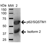 Western Blot - Anti-SQSTM1 / p62 Antibody (A304938) - Antibodies.com