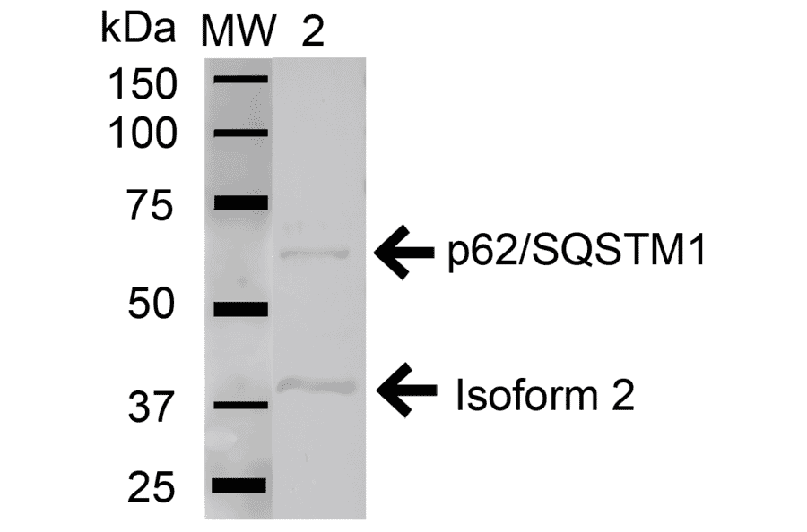 Western Blot - Anti-SQSTM1 / p62 Antibody (A304938) - Antibodies.com
