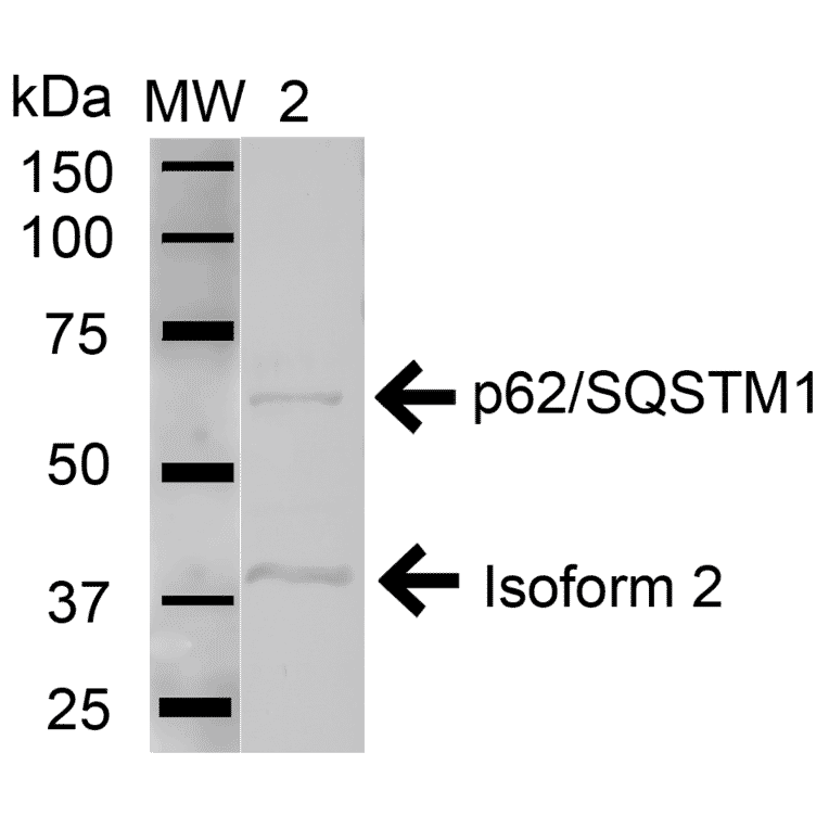Western Blot - Anti-SQSTM1 / p62 Antibody (A304938) - Antibodies.com