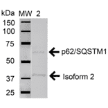 Western Blot - Anti-SQSTM1 / p62 Antibody (A304938) - Antibodies.com