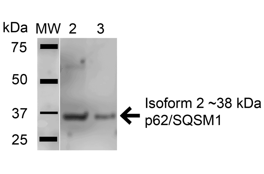 Western Blot - Anti-SQSTM1 / p62 Antibody (A304938) - Antibodies.com
