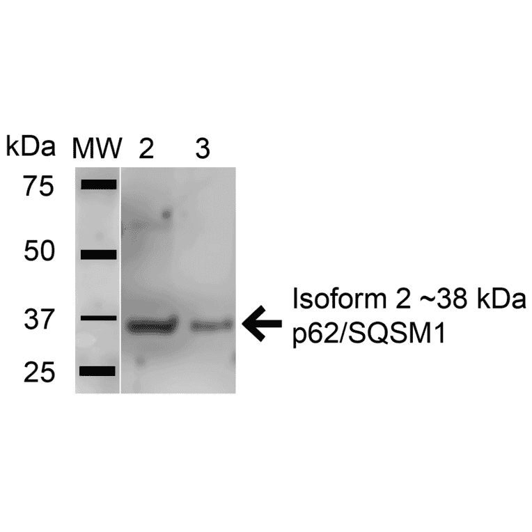 Western Blot - Anti-SQSTM1 / p62 Antibody (A304938) - Antibodies.com
