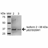 Western Blot - Anti-SQSTM1 / p62 Antibody (A304938) - Antibodies.com