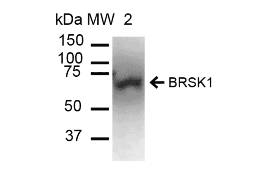 Western Blot - Anti-BRSK1 Antibody (A304939) - Antibodies.com