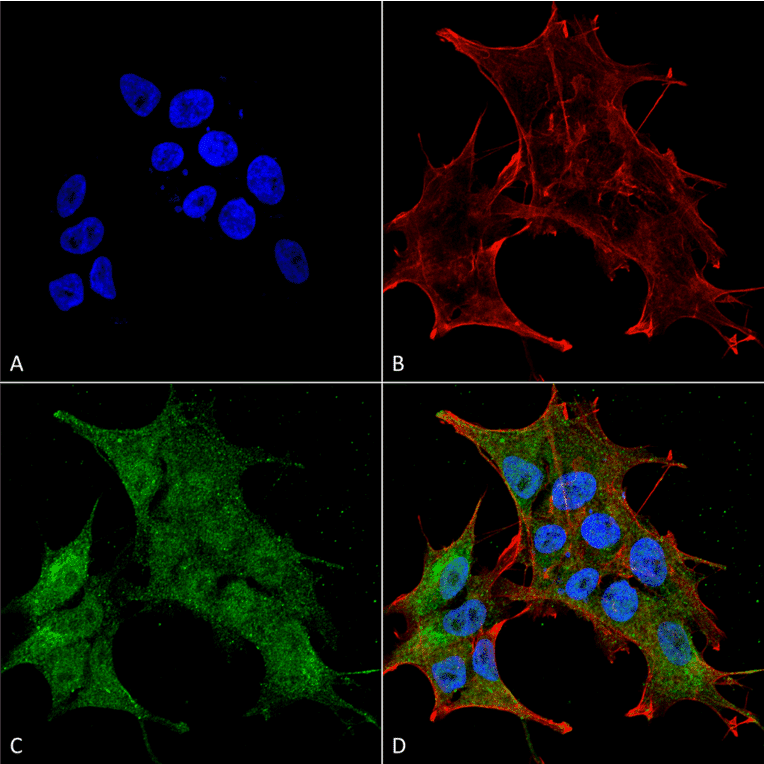 Immunocytochemistry/Immunofluorescence - Anti-BRSK1 Antibody (A304939) - Antibodies.com