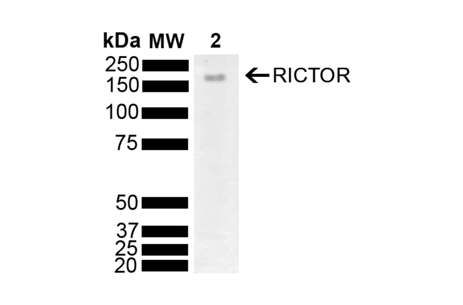 Western Blot - Anti-RICTOR Antibody (A304940) - Antibodies.com