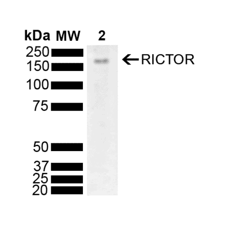 Western Blot - Anti-RICTOR Antibody (A304940) - Antibodies.com