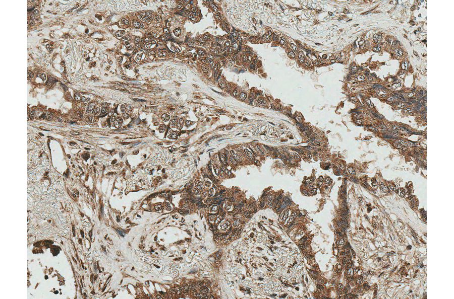 Immunohistochemistry - Anti-RICTOR Antibody (A304940) - Antibodies.com