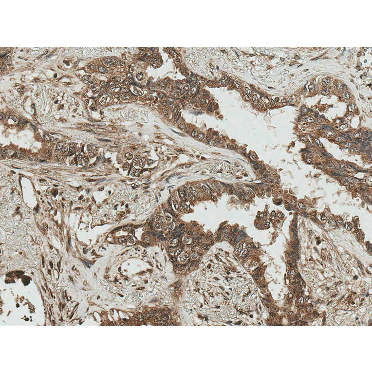 Immunohistochemistry - Anti-RICTOR Antibody (A304940) - Antibodies.com