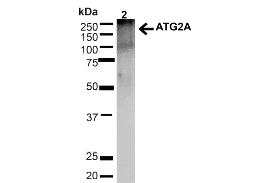 Western Blot - Anti-ATG2A Antibody (A304941) - Antibodies.com