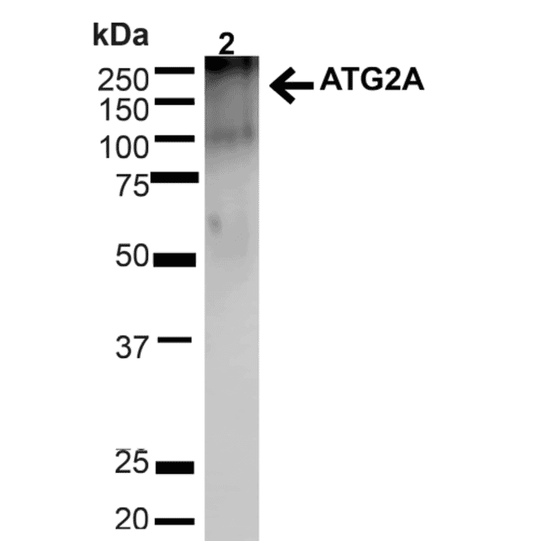 Western Blot - Anti-ATG2A Antibody (A304941) - Antibodies.com