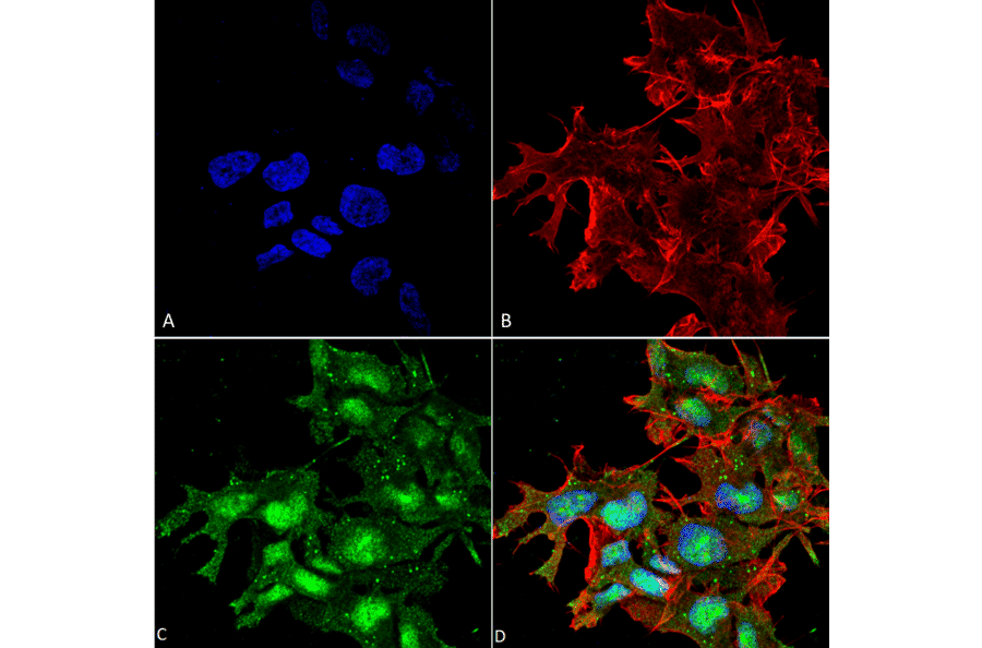 Immunocytochemistry/Immunofluorescence - Anti-ATG2A Antibody (A304941) - Antibodies.com