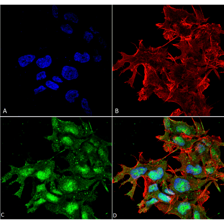 Immunocytochemistry/Immunofluorescence - Anti-ATG2A Antibody (A304941) - Antibodies.com