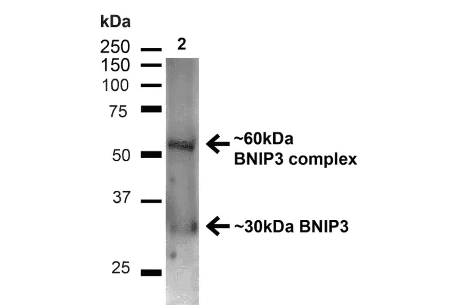 Western Blot - Anti-BNIP3 Antibody (A304942) - Antibodies.com
