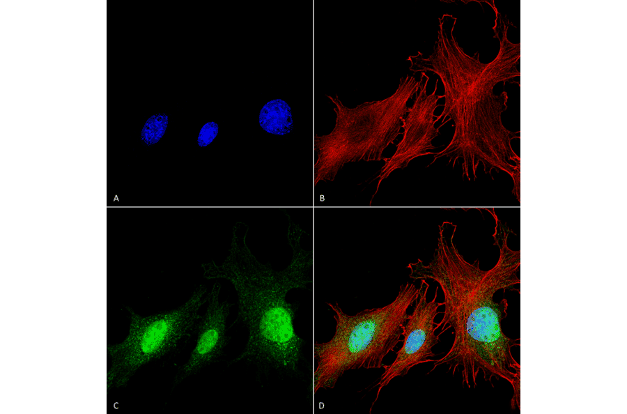 Immunocytochemistry/Immunofluorescence - Anti-BNIP3 Antibody (A304942) - Antibodies.com