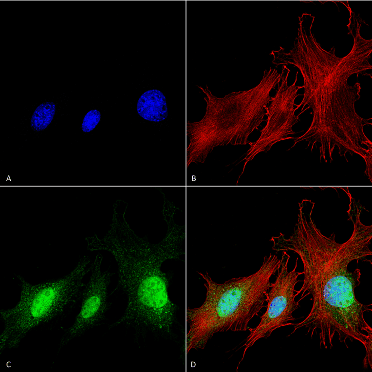 Immunocytochemistry/Immunofluorescence - Anti-BNIP3 Antibody (A304942) - Antibodies.com