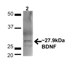 Western Blot - Anti-BDNF Antibody (A304943) - Antibodies.com
