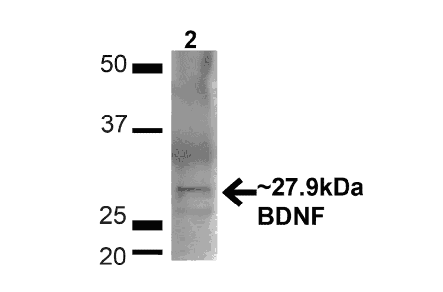 Western Blot - Anti-BDNF Antibody (A304943) - Antibodies.com