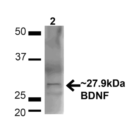 Western Blot - Anti-BDNF Antibody (A304943) - Antibodies.com