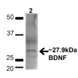 Western Blot - Anti-BDNF Antibody (A304943) - Antibodies.com