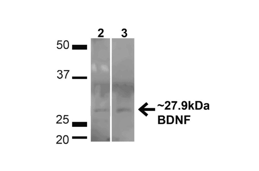 Western Blot - Anti-BDNF Antibody (A304943) - Antibodies.com