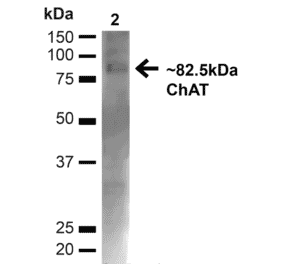 Western Blot - Anti-Choline Acetyltransferase Antibody (A304944) - Antibodies.com