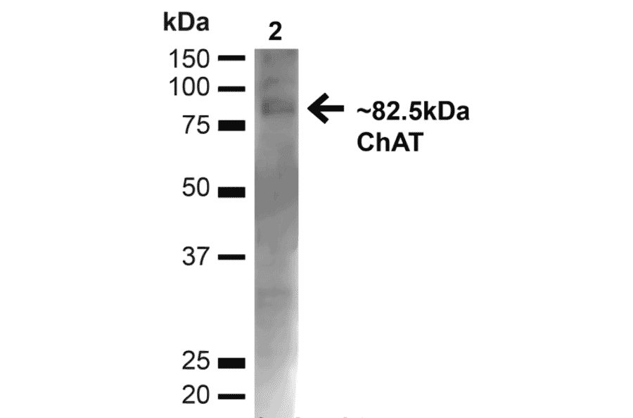 Western Blot - Anti-Choline Acetyltransferase Antibody (A304944) - Antibodies.com