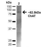 Western Blot - Anti-Choline Acetyltransferase Antibody (A304944) - Antibodies.com