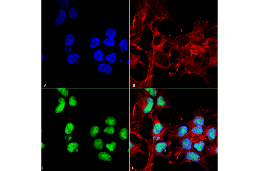 Immunocytochemistry/Immunofluorescence - Anti-Choline Acetyltransferase Antibody (A304944) - Antibodies.com