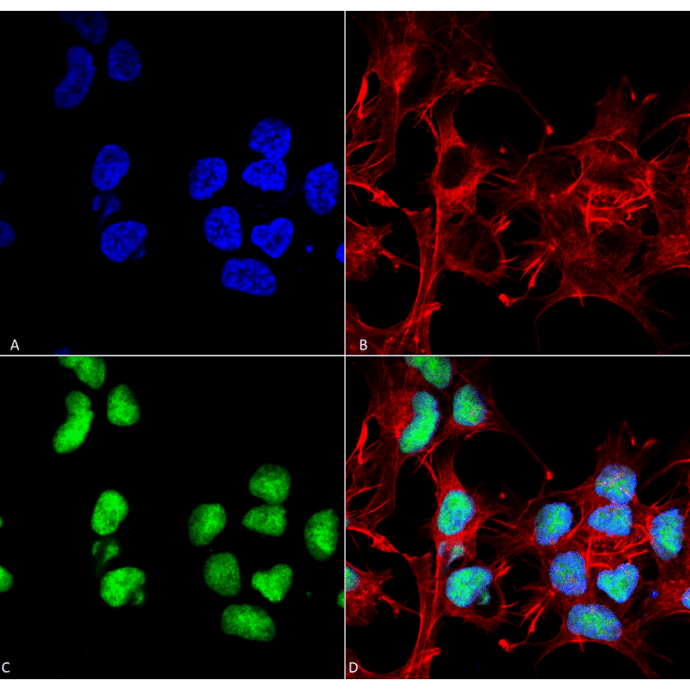 Immunocytochemistry/Immunofluorescence - Anti-Choline Acetyltransferase Antibody (A304944) - Antibodies.com