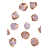 Immunocytochemistry/Immunofluorescence - Anti-PUMA Antibody (A304946) - Antibodies.com