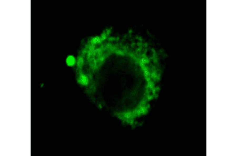 Immunocytochemistry/Immunofluorescence - Anti-LAMP2 Antibody [GL2A7] (A304947) - Antibodies.com