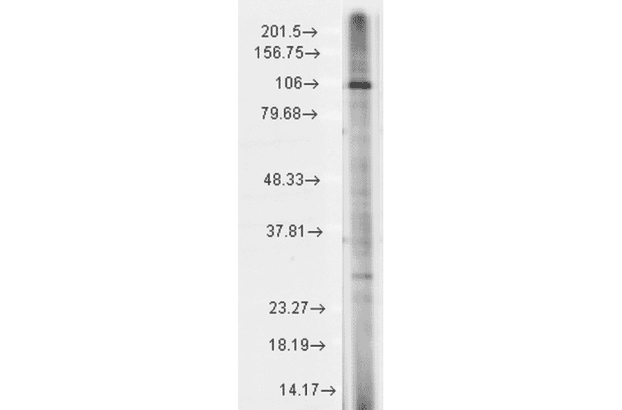 Western Blot - Anti-TRP 7 Antibody [N64A/36] (A304950) - Antibodies.com