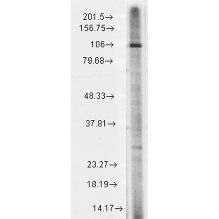 Western Blot - Anti-TRP 7 Antibody [N64A/36] (A304950) - Antibodies.com