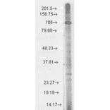 Western Blot - Anti-TRP 7 Antibody [N64A/36] (A304950) - Antibodies.com