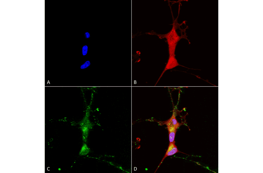 Immunocytochemistry/Immunofluorescence - Anti-TRP 7 Antibody [N64A/36] (A304950) - Antibodies.com