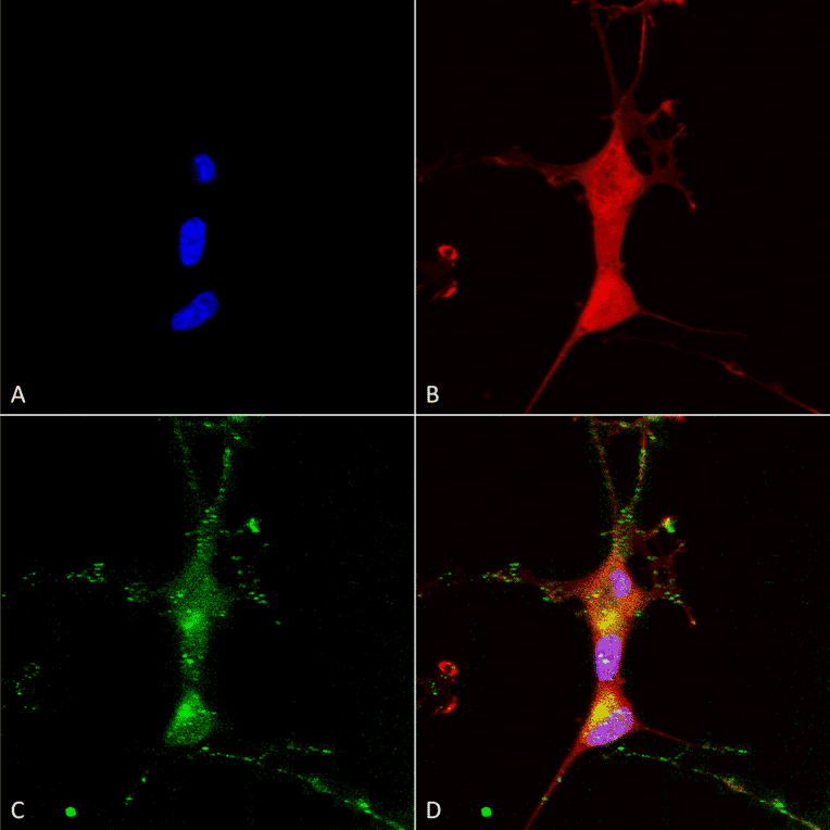 Immunocytochemistry/Immunofluorescence - Anti-TRP 7 Antibody [N64A/36] (A304950) - Antibodies.com