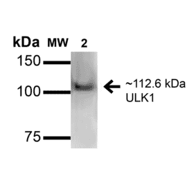 Western Blot - Anti-ULK1 Antibody (A304951) - Antibodies.com
