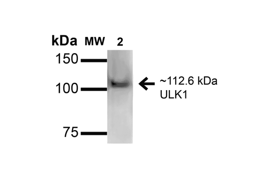 Western Blot - Anti-ULK1 Antibody (A304951) - Antibodies.com