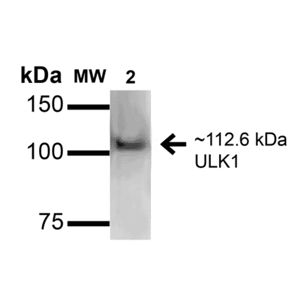 Western Blot - Anti-ULK1 Antibody (A304951) - Antibodies.com