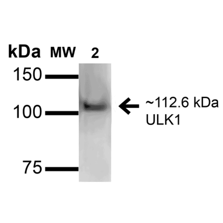 Western Blot - Anti-ULK1 Antibody (A304951) - Antibodies.com