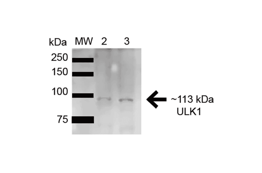 Western Blot - Anti-ULK1 Antibody (A304951) - Antibodies.com
