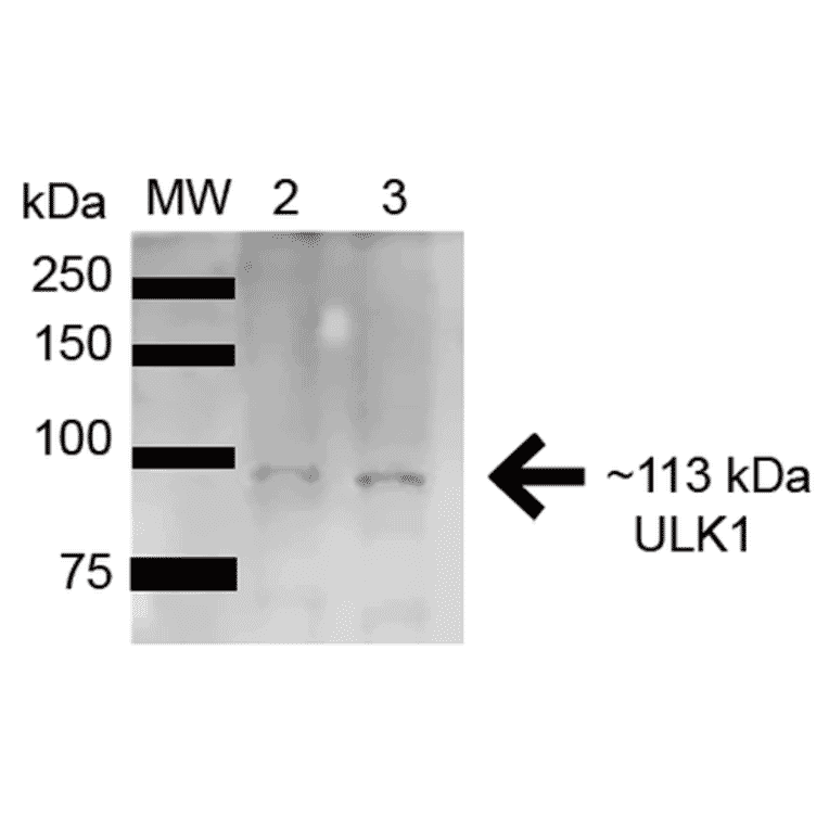 Western Blot - Anti-ULK1 Antibody (A304951) - Antibodies.com