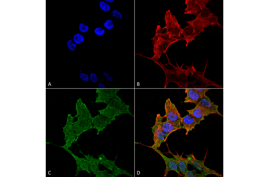 Immunocytochemistry/Immunofluorescence - Anti-ULK1 Antibody (A304951) - Antibodies.com