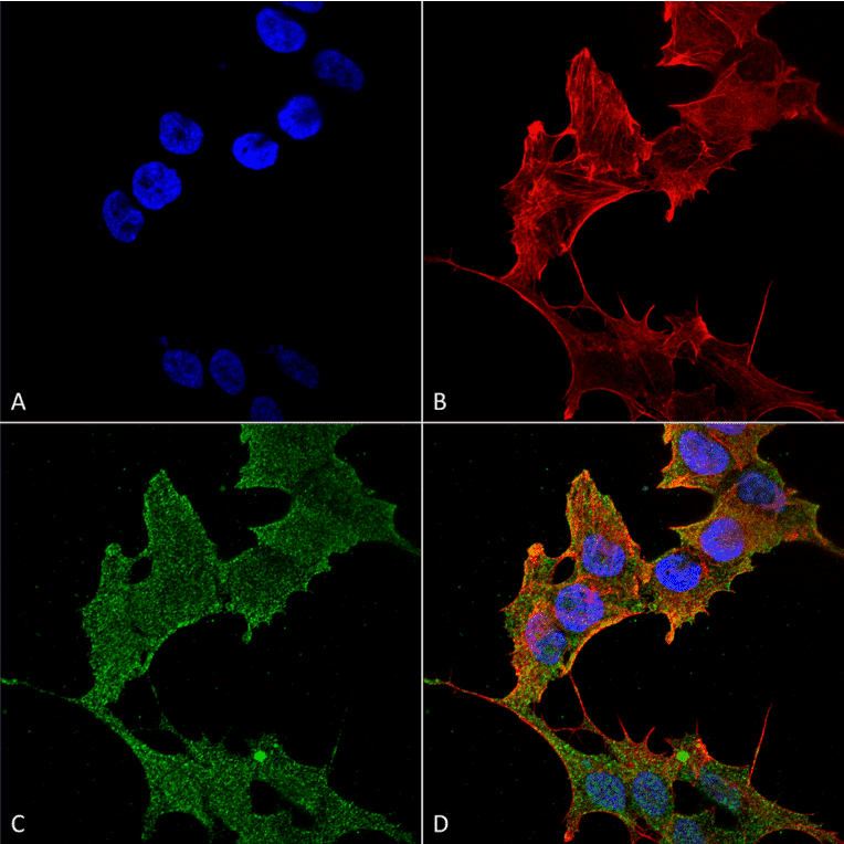 Immunocytochemistry/Immunofluorescence - Anti-ULK1 Antibody (A304951) - Antibodies.com