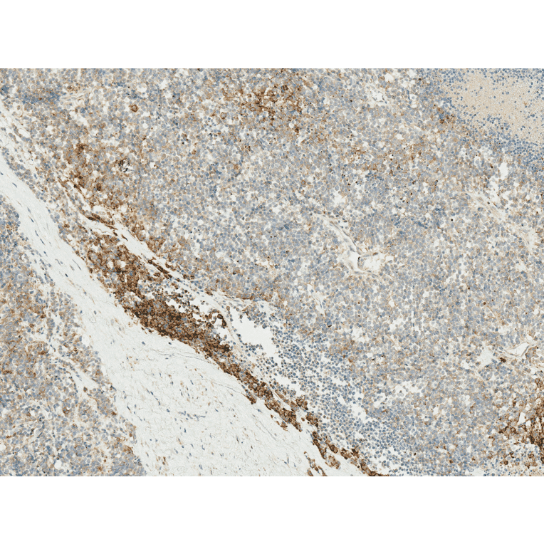 Immunohistochemistry - Anti-VPS34 Antibody (A304952) - Antibodies.com
