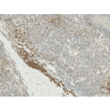 Immunohistochemistry - Anti-VPS34 Antibody (A304952) - Antibodies.com