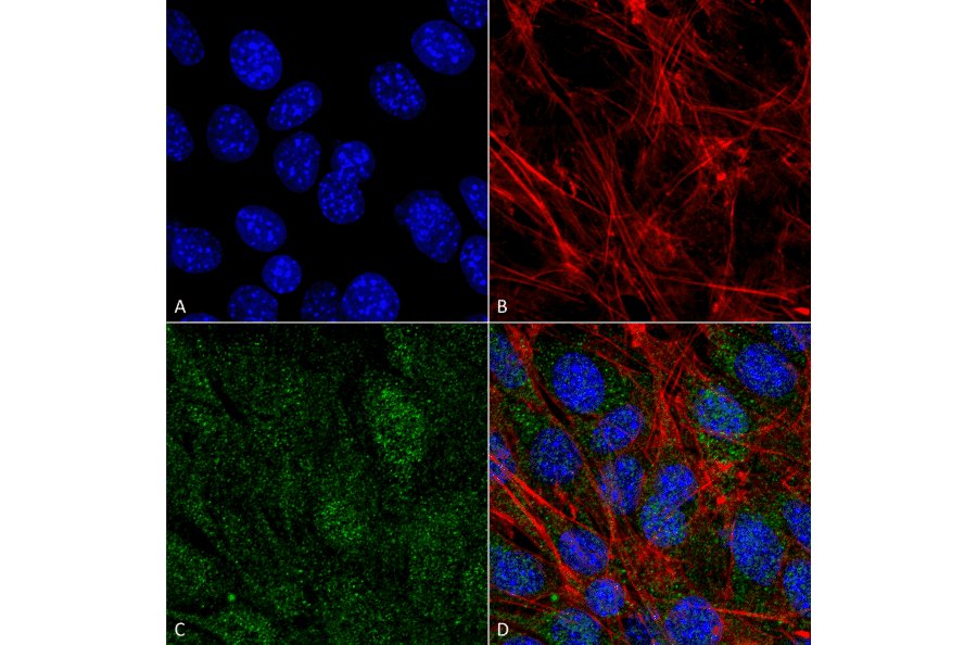 Immunocytochemistry/Immunofluorescence - Anti-VPS34 Antibody (A304952) - Antibodies.com