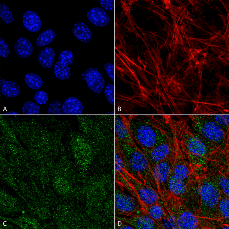 Immunocytochemistry/Immunofluorescence - Anti-VPS34 Antibody (A304952) - Antibodies.com