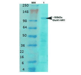 Western Blot - Anti-NMDAR1 Antibody [S308-48] (A304953) - Antibodies.com